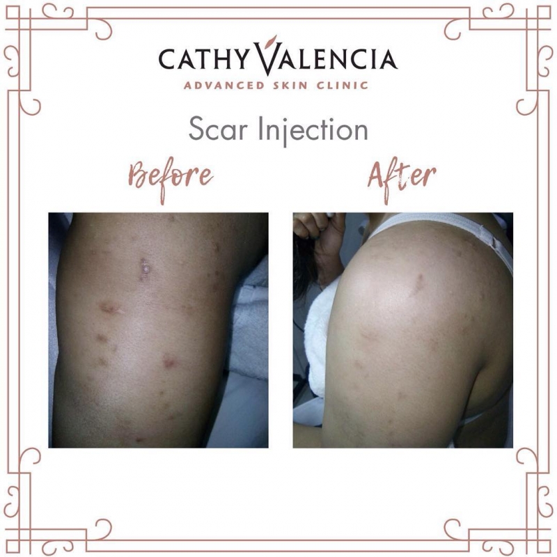 CV DRIPS/INJECTIONS Cathy Valencia